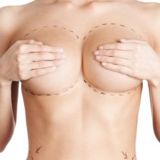 breast-1.jpg